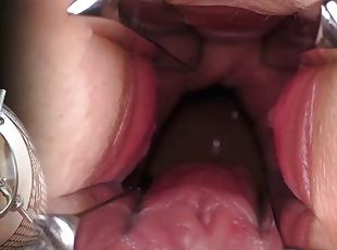 Orgasme, Chatte (Pussy), Amateur, Milf, Allemand, Point de vue, Fétiche, Examen gyno, Insertion