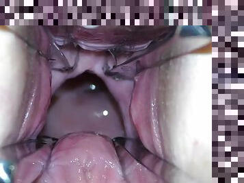 Mistresss cunt is opened with a hole dilator so that you can examine her cervix