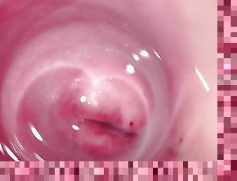 Camera deep inside Mia&#039;s creamy pussy, teen Cervix close up