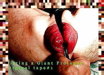 Fisting a Giant Prolapse, original tape #1