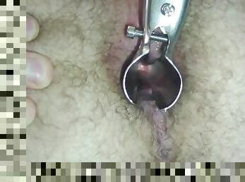 Anal speculum and prostate stimulator orgasm