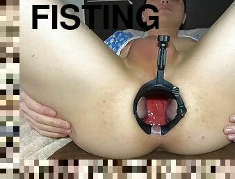 fisting, énorme, monstre, anal, jouet, célébrité, gay, bdsm, gode, solo