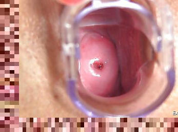 Toys and medical tools inside a wide-open brunette hole
