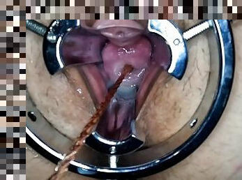 Cervix play and gaping pussy.