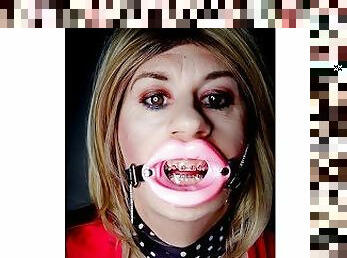 Open mouth lip gag and braces fetish featuring Alexandra Braces